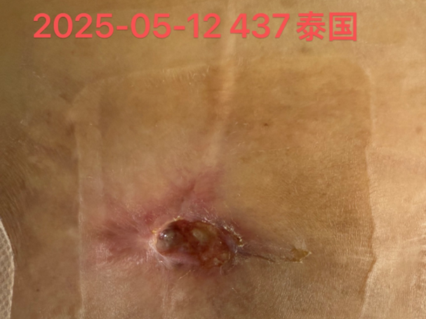 qinb04_518372.png