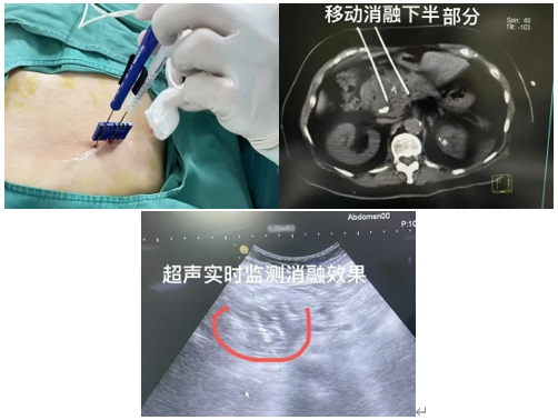 图片3-3.png