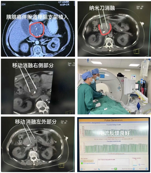 图片3-2.png