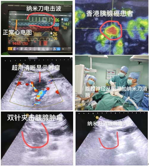 图片3-1.png