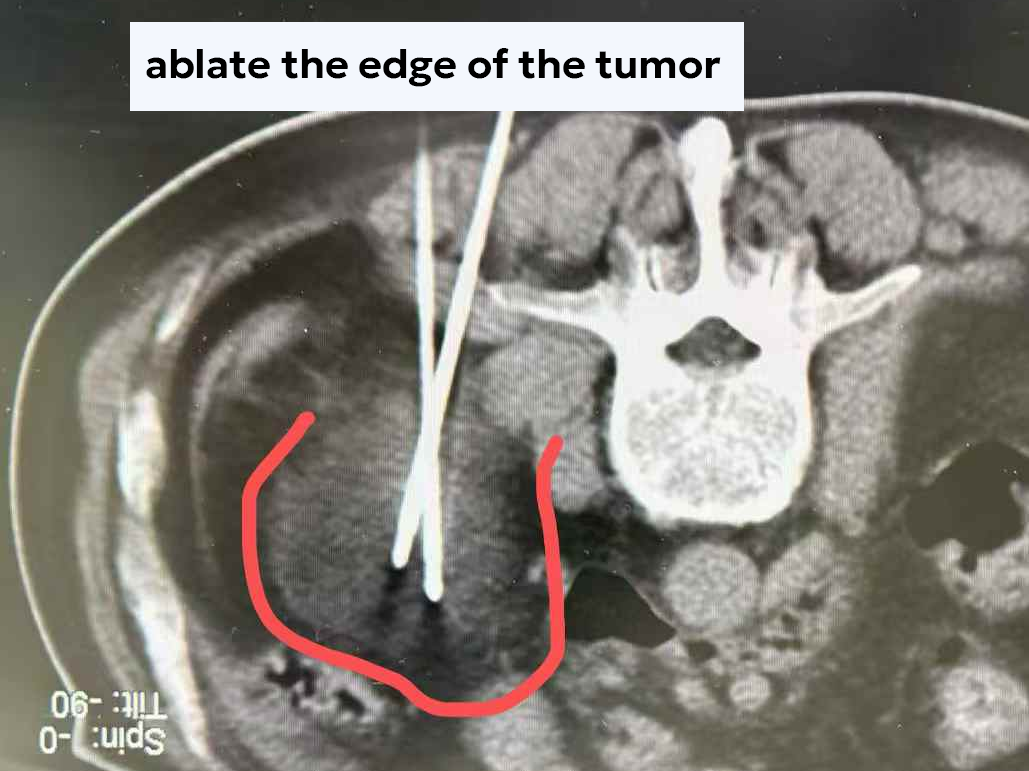 qinb16_579216.png qinb16_579216.png