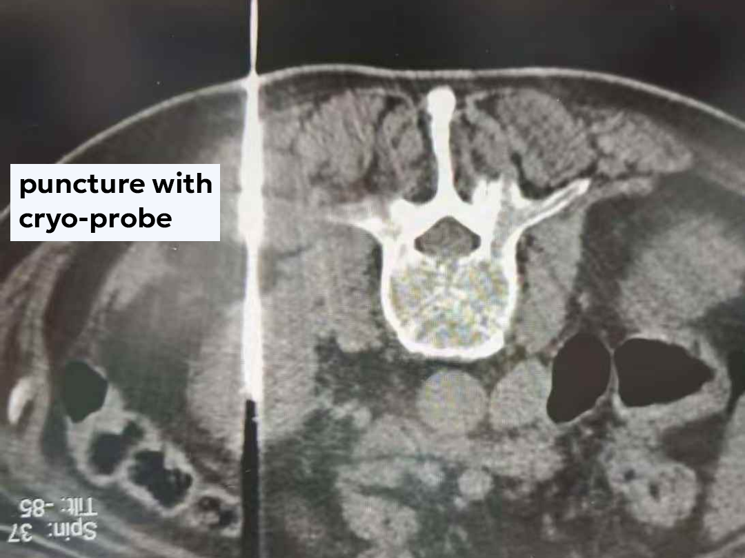 qinb16_774371.png qinb16_774371.png