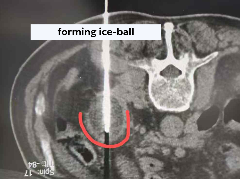 qinb16_849655.png qinb16_849655.png