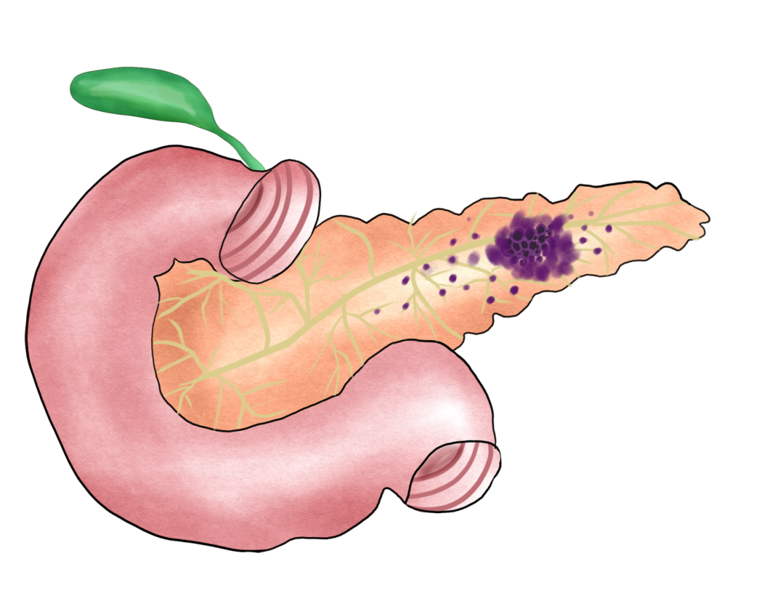 qinb18_409747.png qinb18_409747.png