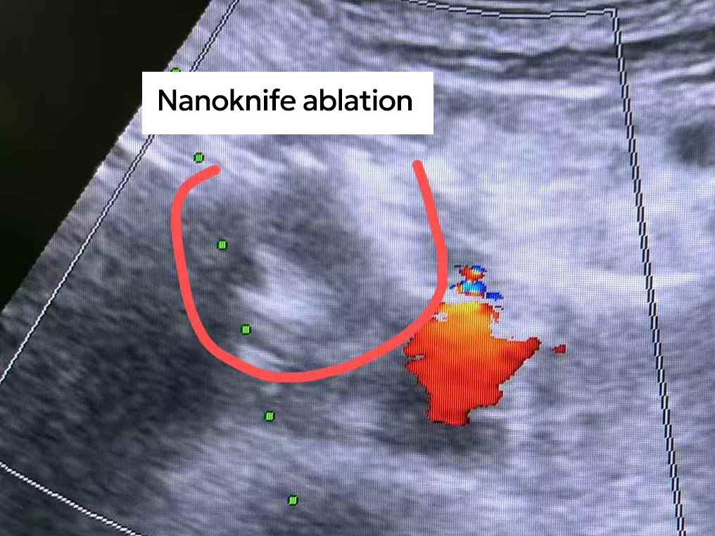 qinb18_475918.png qinb18_475918.png