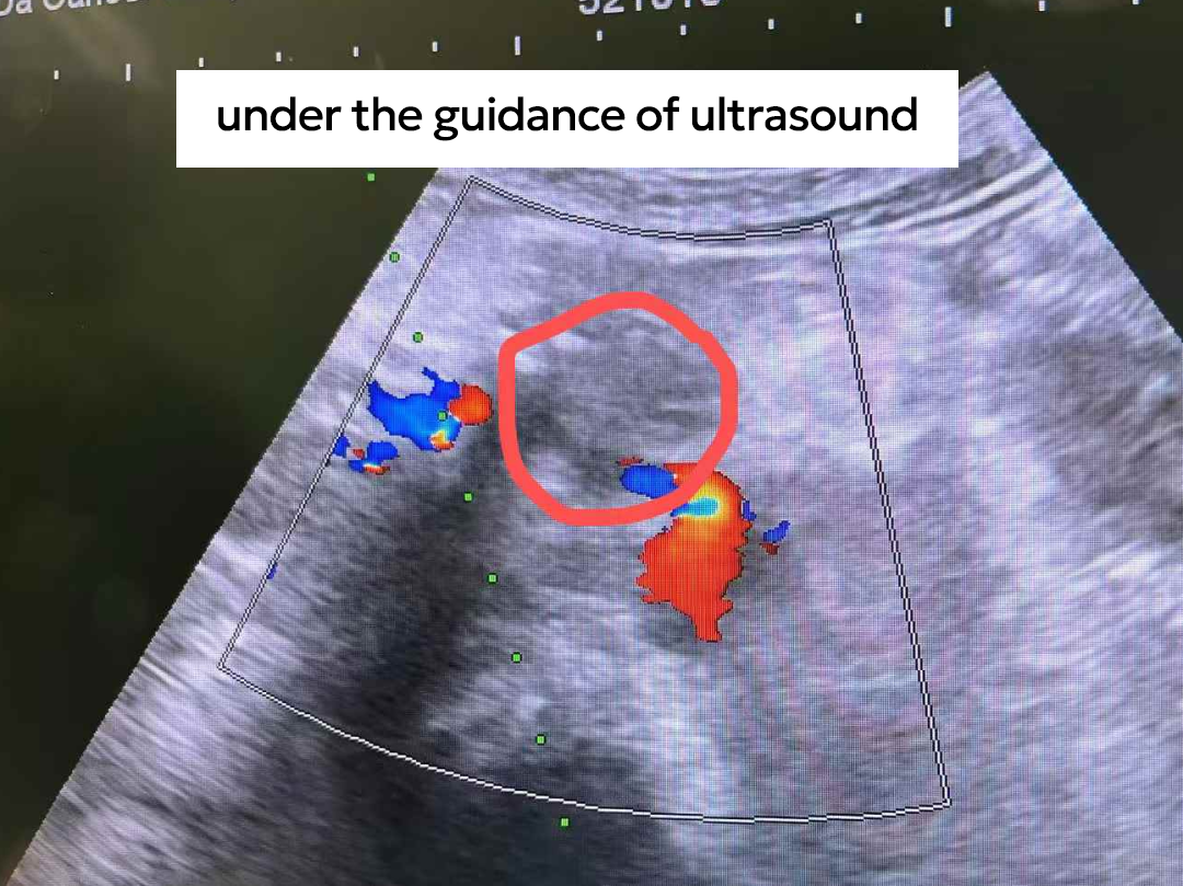 qinb18_741512.png qinb18_741512.png