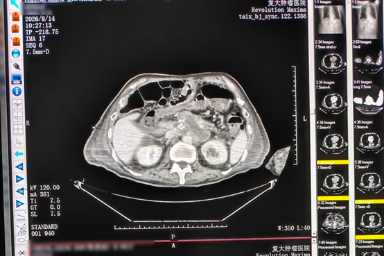 qinb18_107733.png 图片9.png