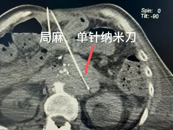 qinb18_291147.jpg 图片5.jpg