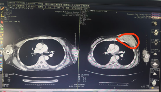 qinb10_766517.png 图片3.png